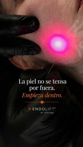 Publicación de Instagram: La precisión de una fibra óptica del grosor de un cabello puede transformar la piel desde el interior. ✨