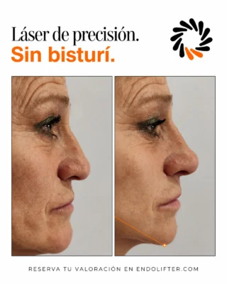 Publicación de Instagram: Esa pequeña sombra bajo la mandíbula que antes no estaba, ahora define cómo te sientes frente al espejo.